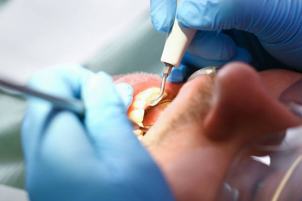 Best Dental Abscess Treatment in Governors Village, NC