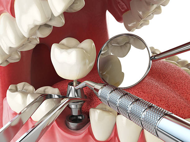 Best After-Hours Dental Care in Governors Village, NC